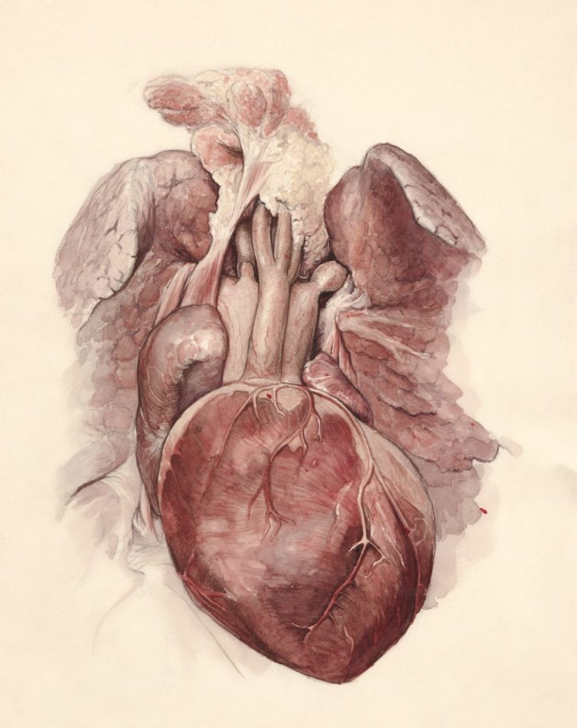 Chirurgie Cardio-Vasculaire a drawing of a human heart with wings