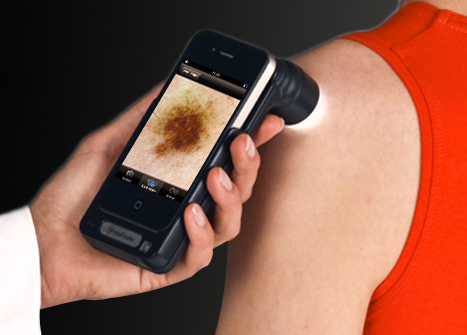 dermoscopie - dermato 