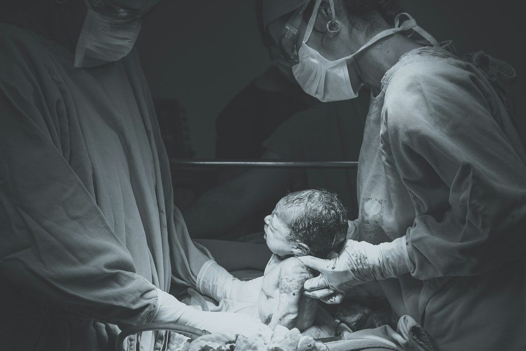 Gynecologie obstetrique
greyscale photo of medical operation
